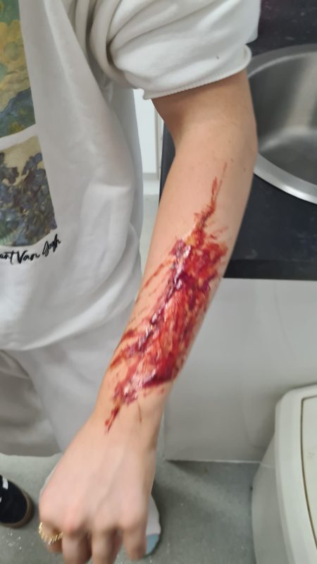 A young leader's arm with a blood covered fake wound